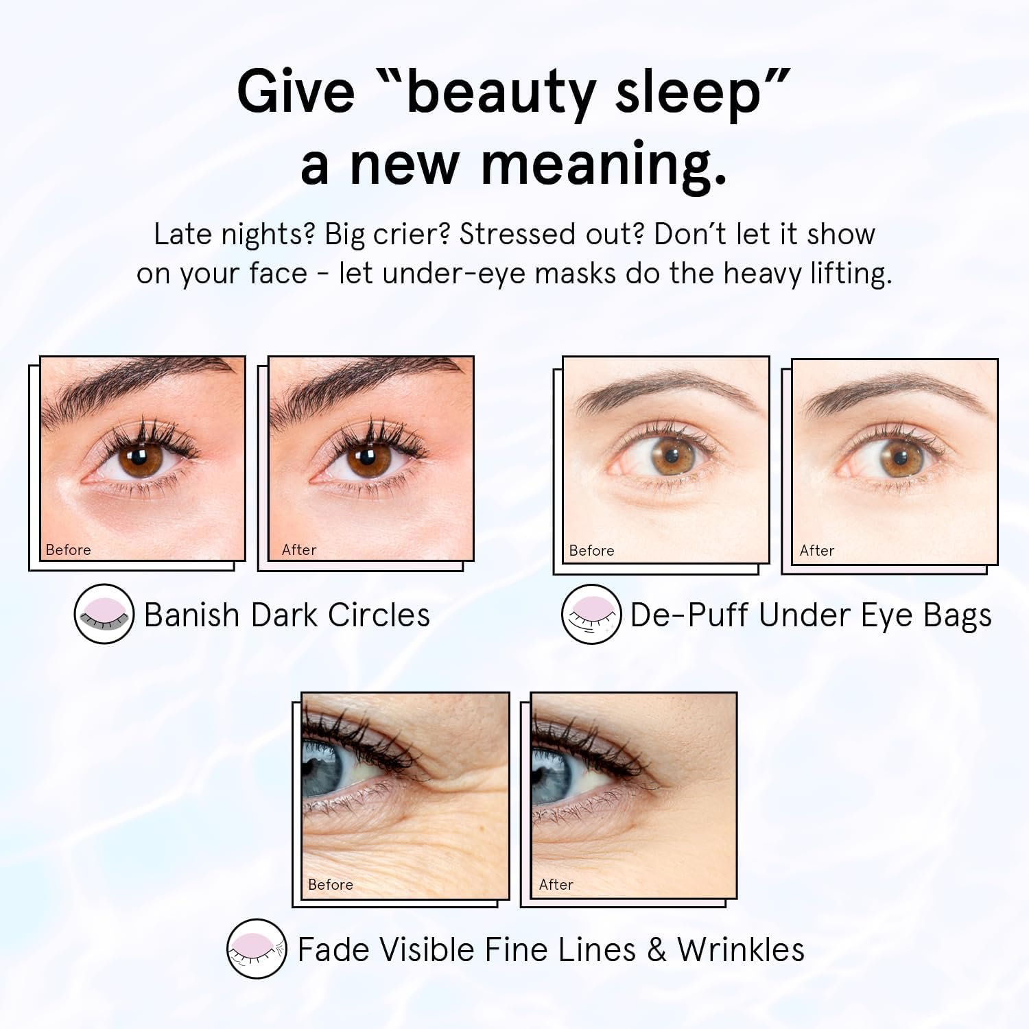 grace & stella Under Eye Patches for Puffy Eyes and Dark Circles (Retinol, 24 Pairs) Restoring Gel Under Eye Masks with Hyaluronic Acid - Vegan Cruelty-Free Skincare Birthday Gifts for Women 3 grace & stella Under Eye Patches for Puffy Eyes and Dark Circles (Retinol, 24 Pairs) Restoring Gel Under Eye Masks with Hyaluronic Acid - Vegan Cruelty-Free Skincare Birthday Gifts for Women - Image 3