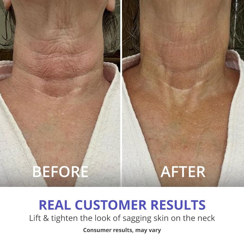 goPure Neck Firming Cream - Anti-Aging Neck Cream for Tightening and Wrinkles for an Even Skin Tone and Neck Lift - With Pro-Active Firming Complex, 1.7 oz 6 goPure Neck Firming Cream - Anti-Aging Neck Cream for Tightening and Wrinkles for an Even Skin Tone and Neck Lift - With Pro-Active Firming Complex, 1.7 oz - Image 6