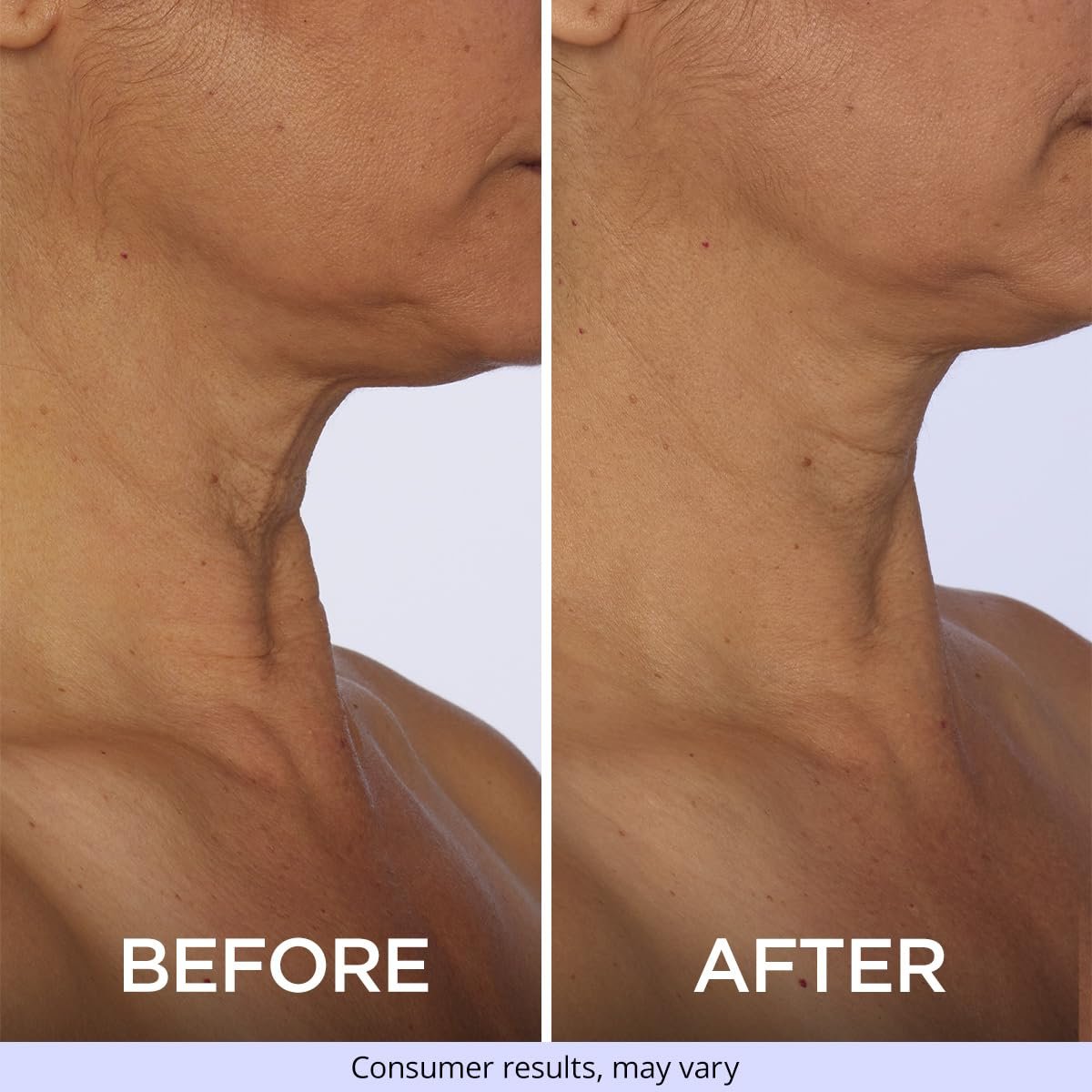 goPure Neck Firming Cream - Anti-Aging Neck Cream for Tightening and Wrinkles for an Even Skin Tone and Neck Lift - With Pro-Active Firming Complex, 1.7 oz 3 goPure Neck Firming Cream - Anti-Aging Neck Cream for Tightening and Wrinkles for an Even Skin Tone and Neck Lift - With Pro-Active Firming Complex, 1.7 oz - Image 3