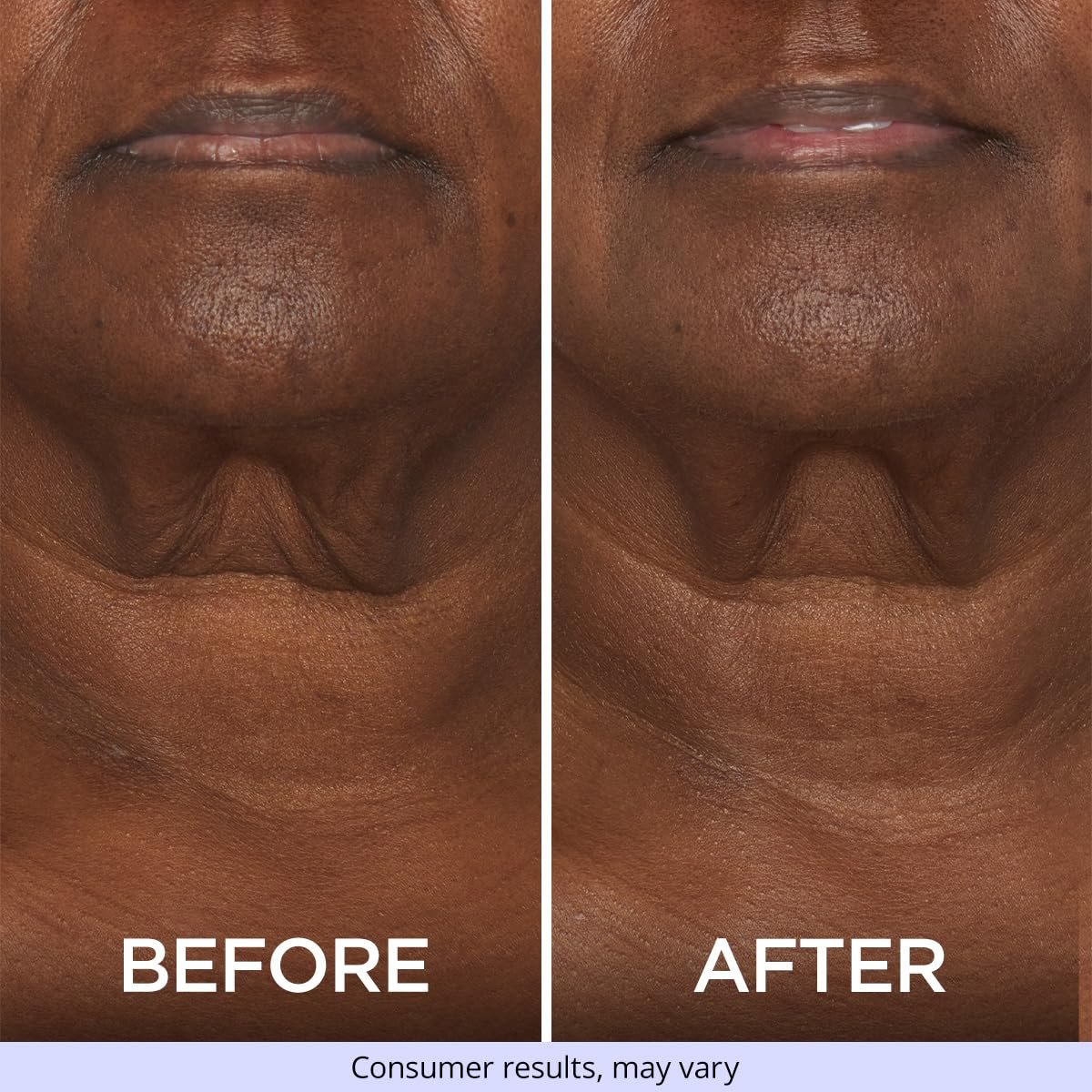 goPure Neck Firming Cream - Anti-Aging Neck Cream for Tightening and Wrinkles for an Even Skin Tone and Neck Lift - With Pro-Active Firming Complex, 1.7 oz 4 goPure Neck Firming Cream - Anti-Aging Neck Cream for Tightening and Wrinkles for an Even Skin Tone and Neck Lift - With Pro-Active Firming Complex, 1.7 oz - Image 4