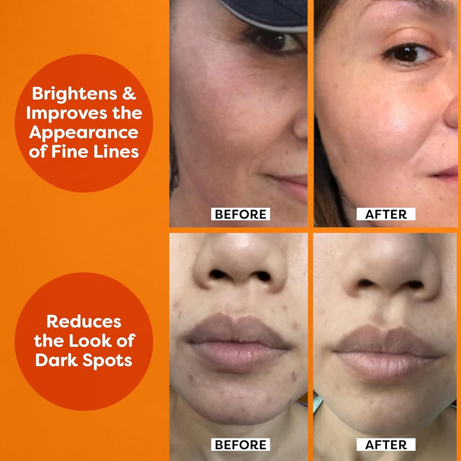 TruSkin Vitamin C Serum – Anti Aging Facial Serum with Vitamin C, Hyaluronic Acid, Vitamin E – Brightening Serum – Even Skin Tone, Improve Appearance of Dark Spots, Fine Lines & Wrinkles, 2 Fl Oz 4 TruSkin Vitamin C Serum – Anti Aging Facial Serum with Vitamin C, Hyaluronic Acid, Vitamin E – Brightening Serum – Even Skin Tone, Improve Appearance of Dark Spots, Fine Lines & Wrinkles, 2 Fl Oz - Image 4