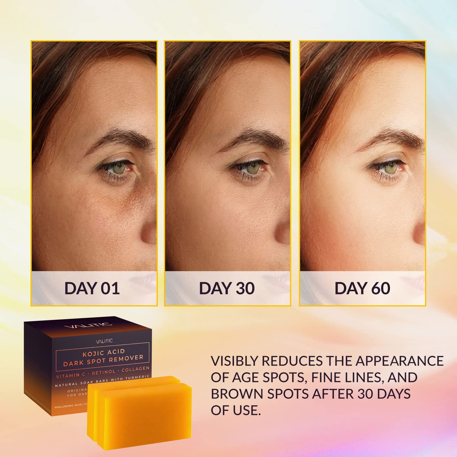 VALITIC Kojic Acid Dark Spot Remover Soap Bars with Vitamin C, Retinol, Collagen, Turmeric - Original Japanese Complex Infused with Hyaluronic Acid, Vitamin E, Shea Butter, Castile Olive Oil (2 Pack) 2 VALITIC Kojic Acid Dark Spot Remover Soap Bars with Vitamin C, Retinol, Collagen, Turmeric - Original Japanese Complex Infused with Hyaluronic Acid, Vitamin E, Shea Butter, Castile Olive Oil (2 Pack) - Image 2