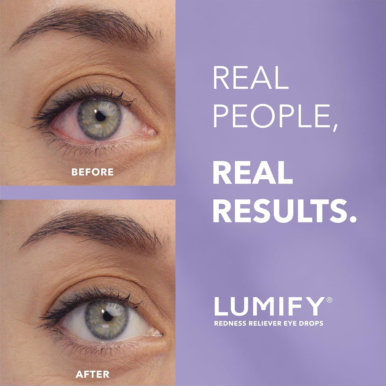 LUMIFY Redness Reliever Eye Drops, For Whiter & Brighter Looking Eyes, 0.08 Fl Oz (2.5 mL) 2 LUMIFY Redness Reliever Eye Drops, For Whiter & Brighter Looking Eyes, 0.08 Fl Oz (2.5 mL) - Image 2